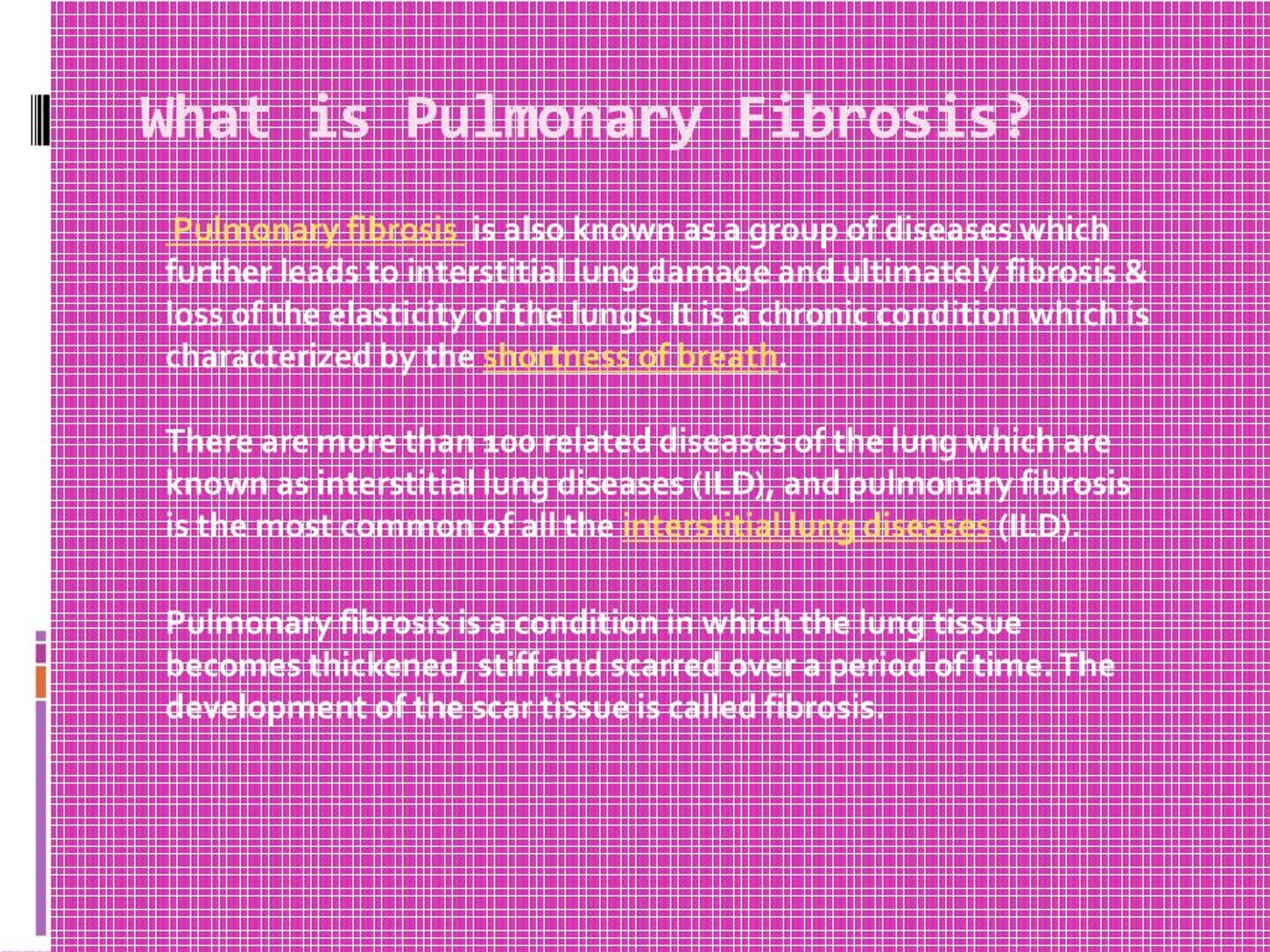 pulmonary fibrosis case presentation ppt