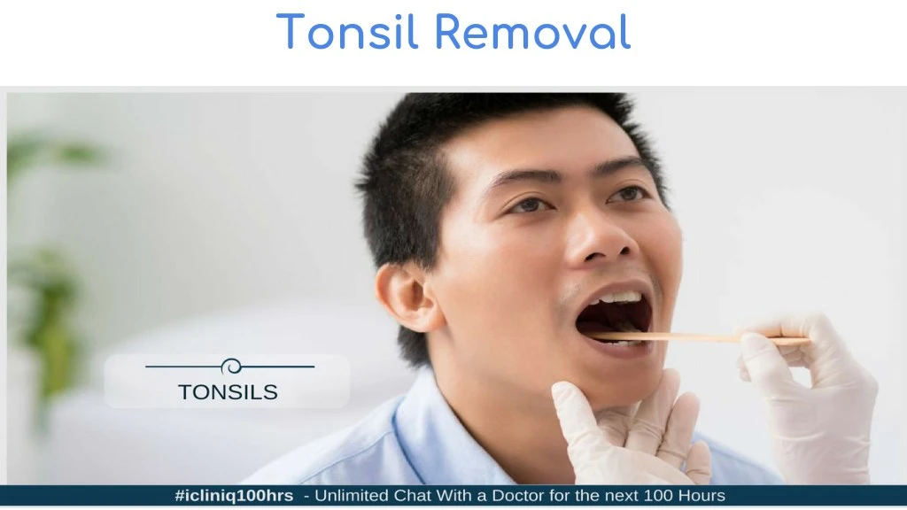 tonsil removal n.