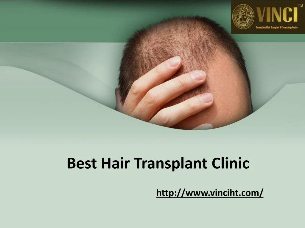 best hair transplant clinic n.