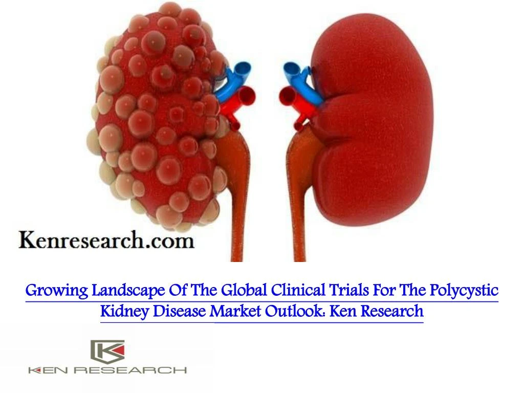 clinical presentation of polycystic kidneys