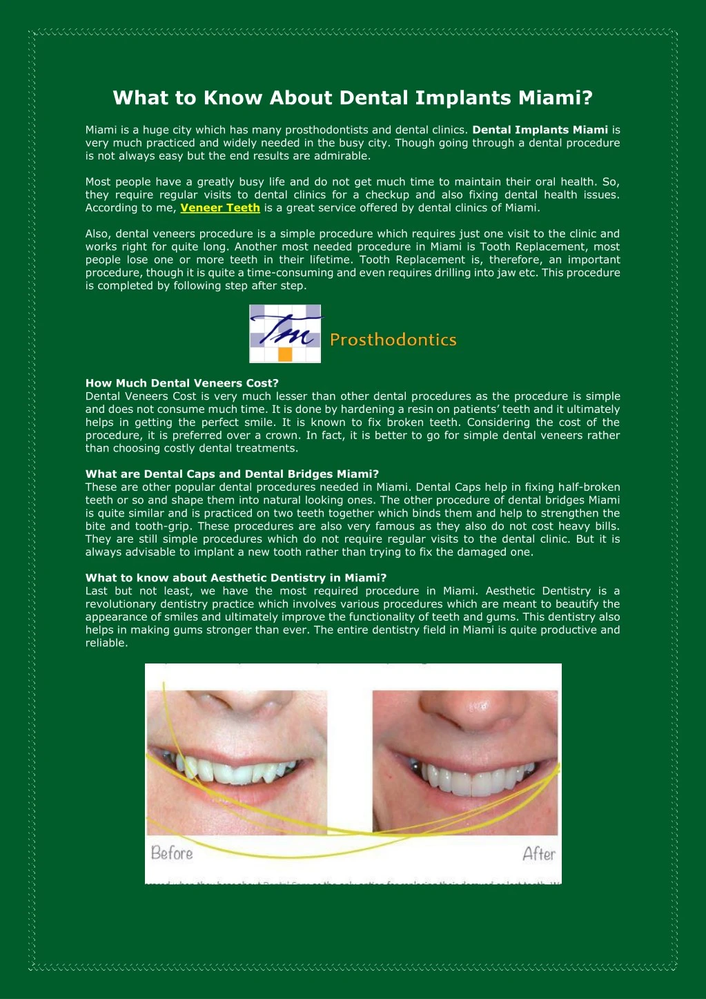 what to know about dental implants miami n.