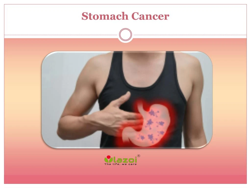 ppt-stomach-cancer-causes-symptoms-daignosis-prevention-and