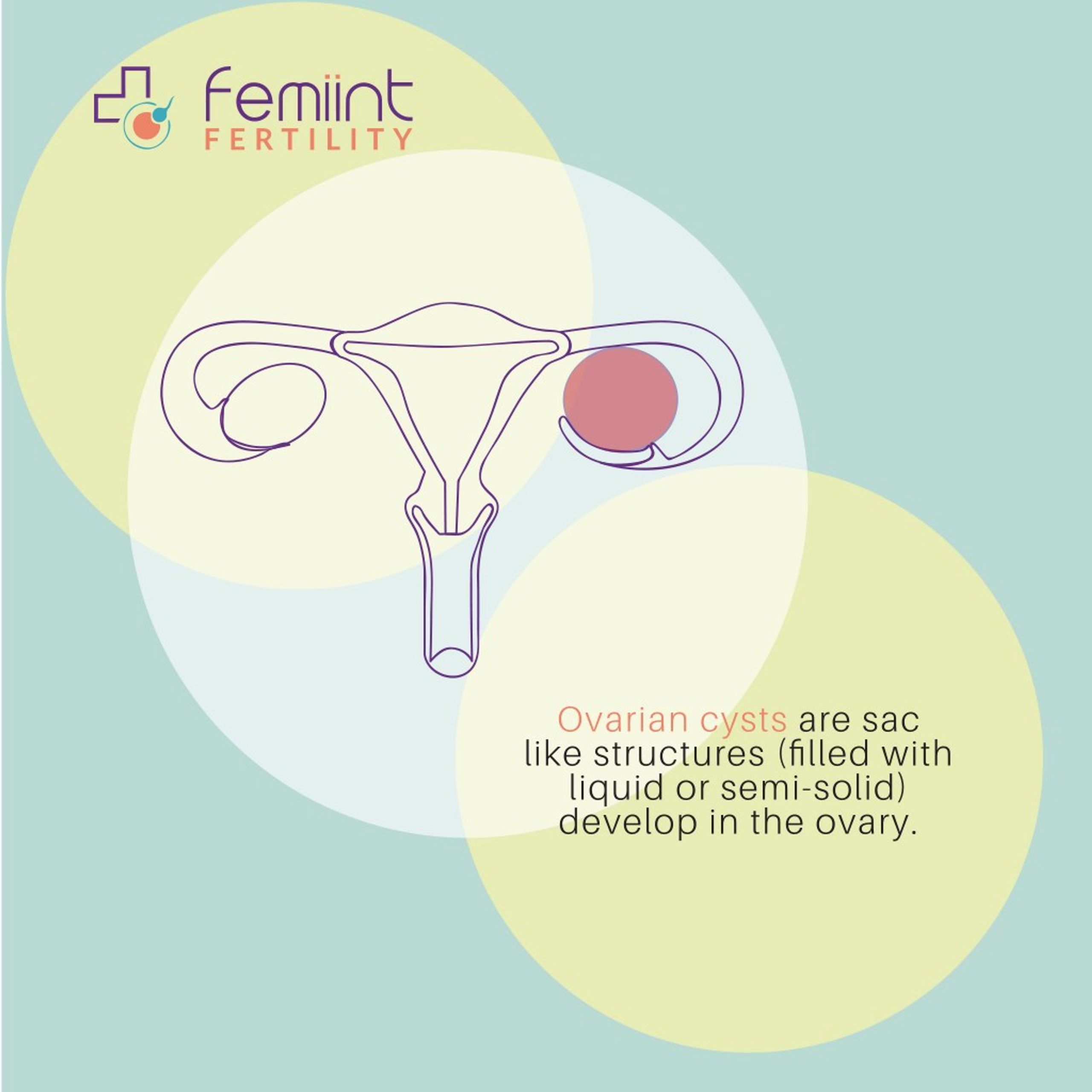 Ppt Does Ovarian Cysts Aï¬€ect Your Fertility Powerpoint Presentation Id8008375