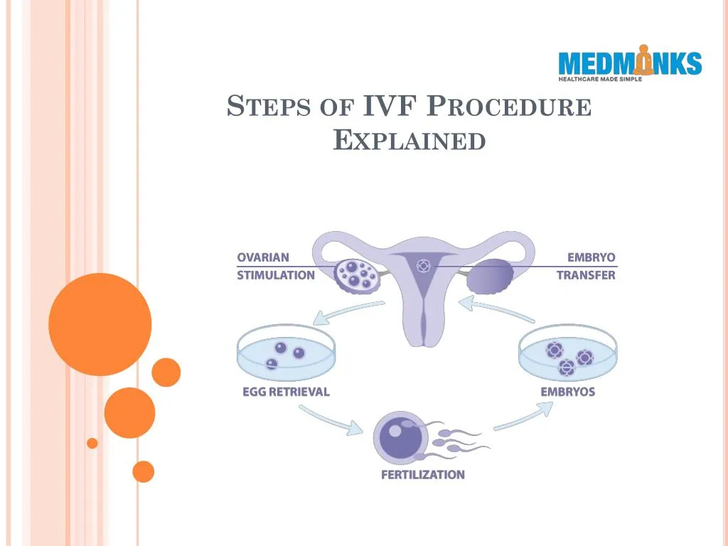 Ppt Steps Of Ivf Procedure Explained Powerpoint Presentation Free Download Id8008888 1787