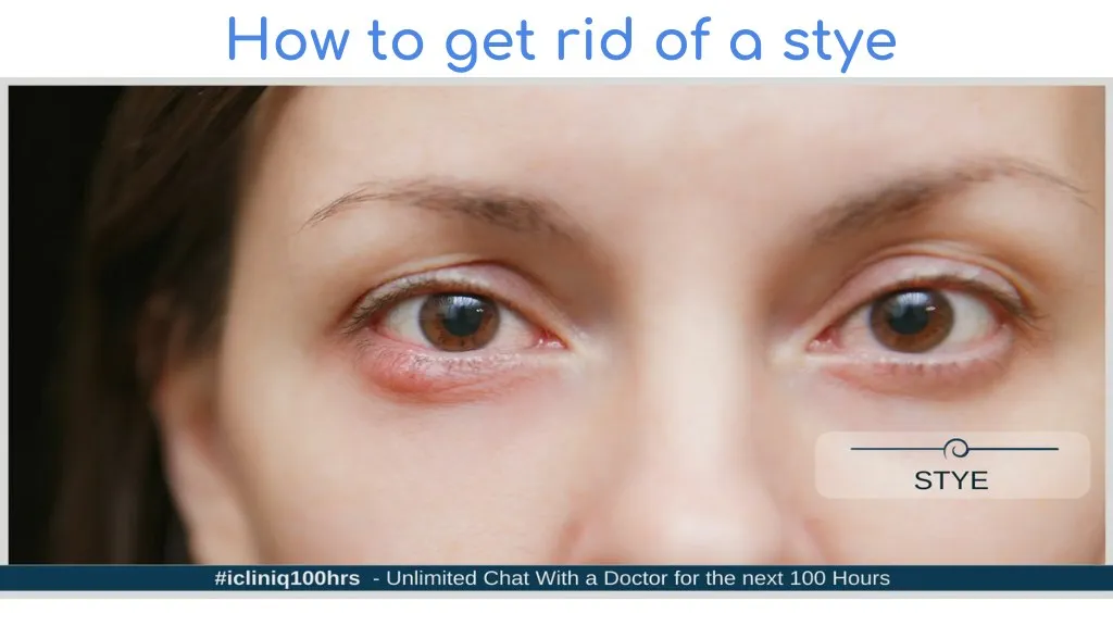 Ppt How To Get Rid Of A Stye Powerpoint Presentation Free Download