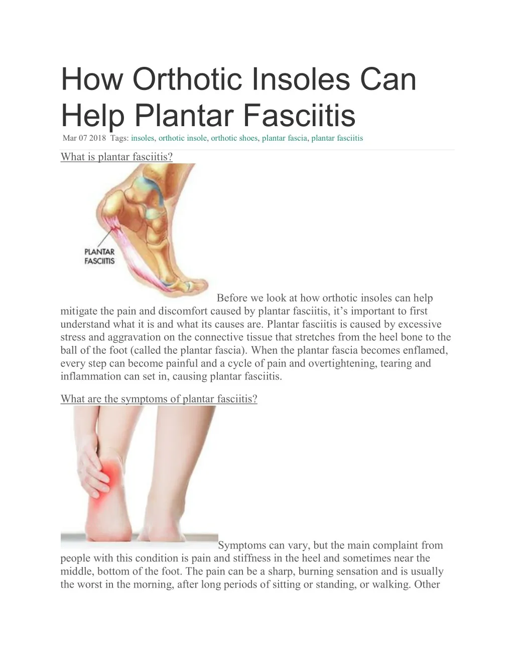 Ppt How Orthotic Insoles Can Help Plantar Fasciitis Powerpoint Presentation Id8016293 3351