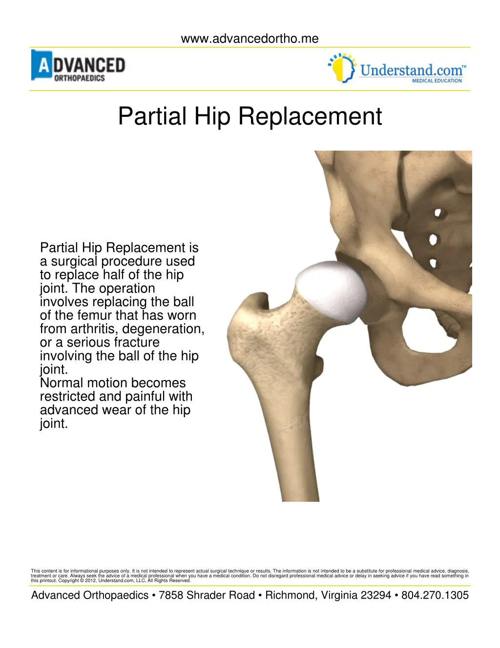 ppt-partial-hip-replacement-surgery-pdf-shri-ramchandra-joint