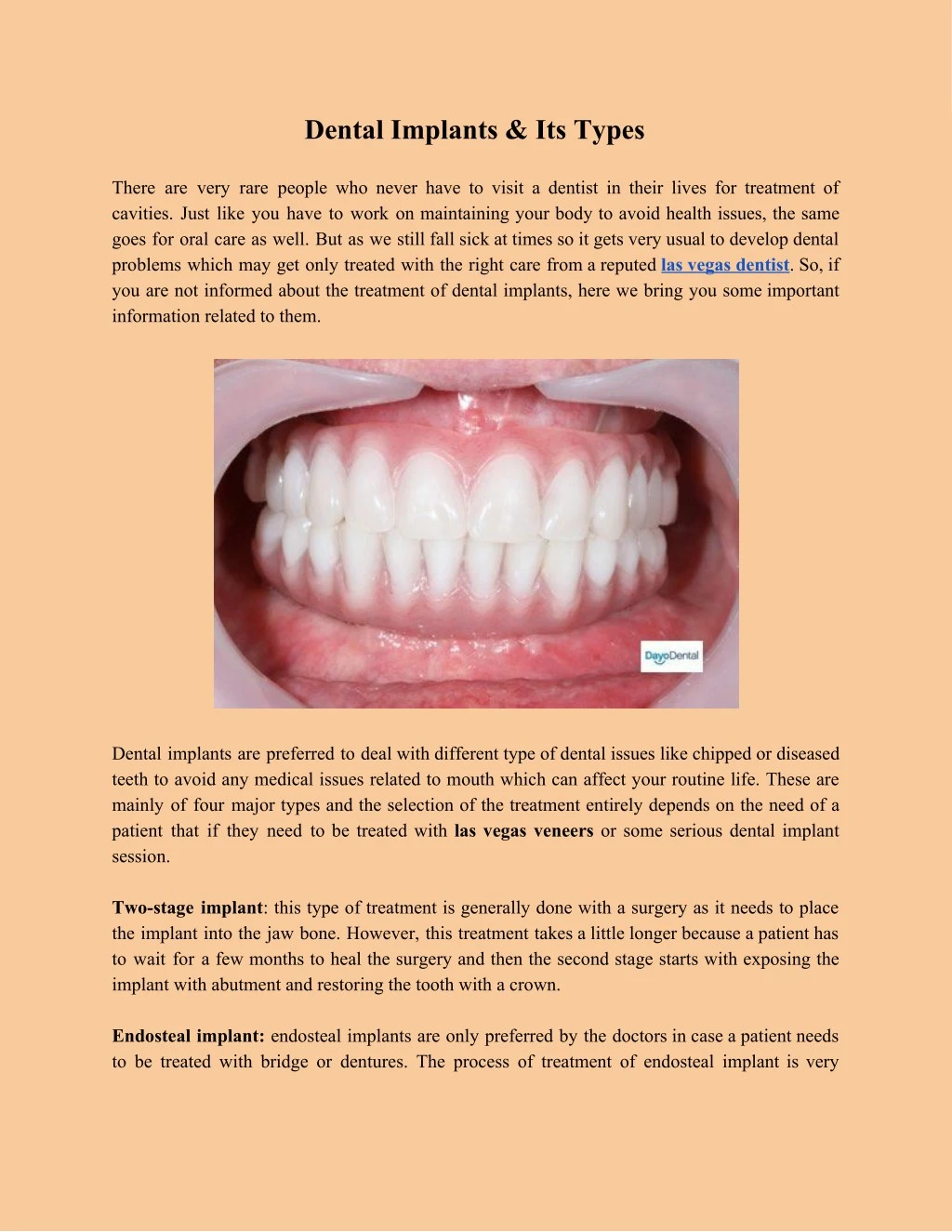dental implants its types n.