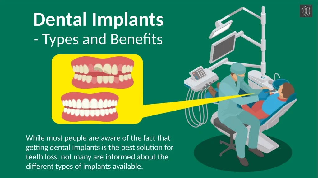 dental implants types and benefits n.