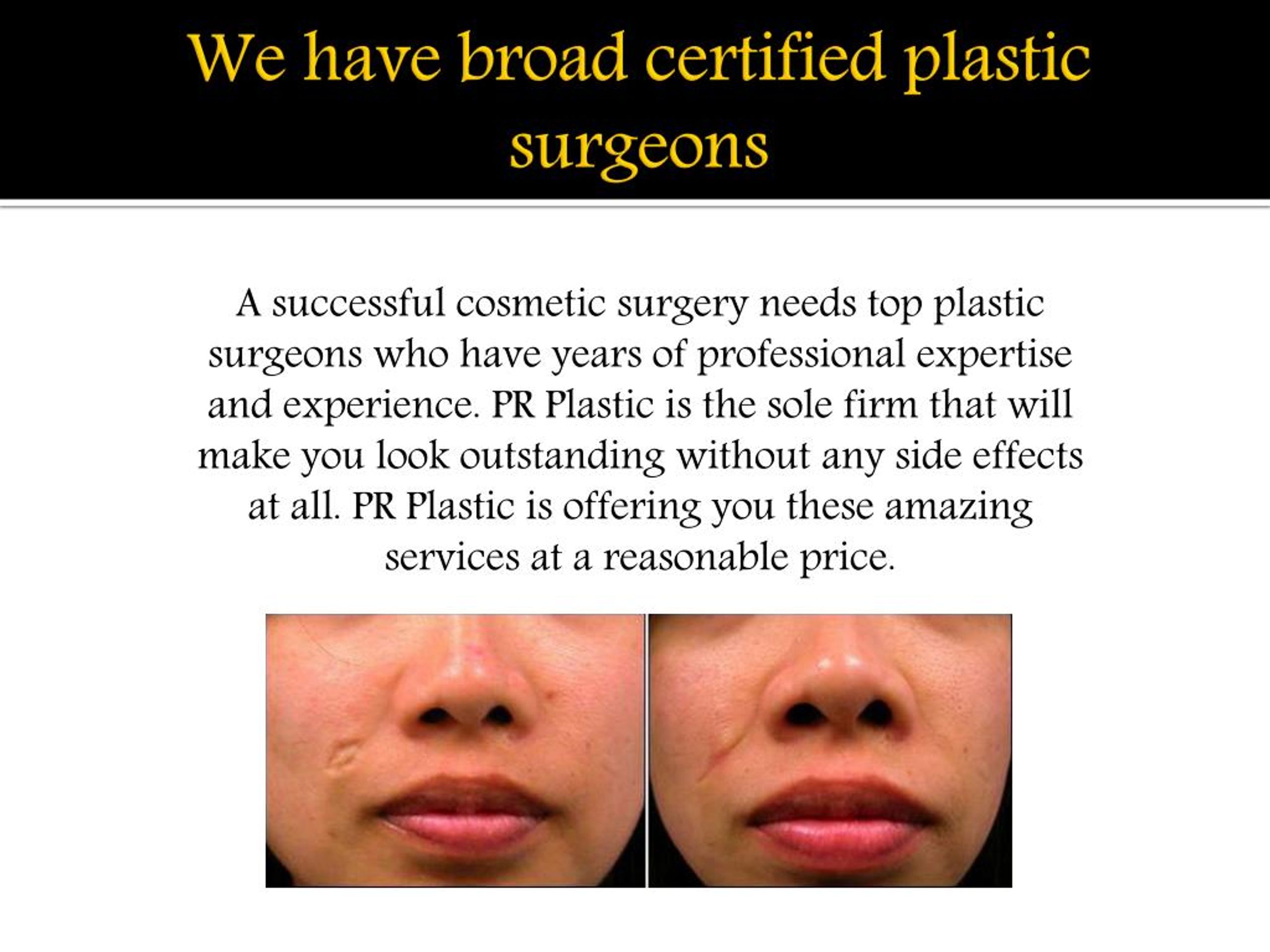 PPT - Chicago Cosmetic Surgery | Chicago Plastic Surgery | Top Plastic ...