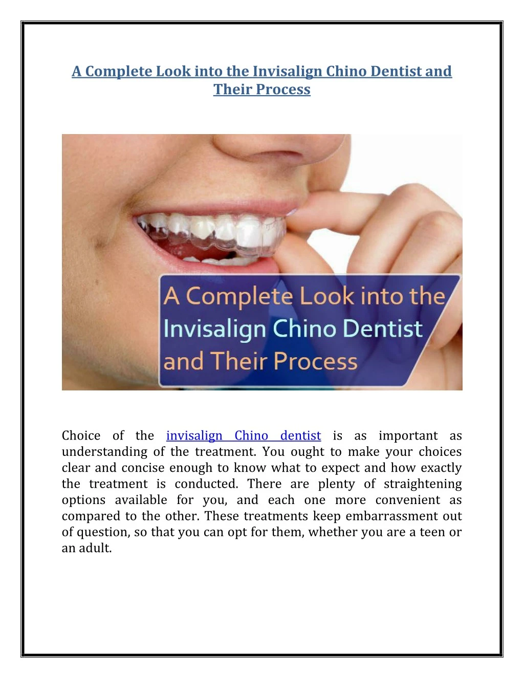 a complete look into the invisalign chino dentist n.