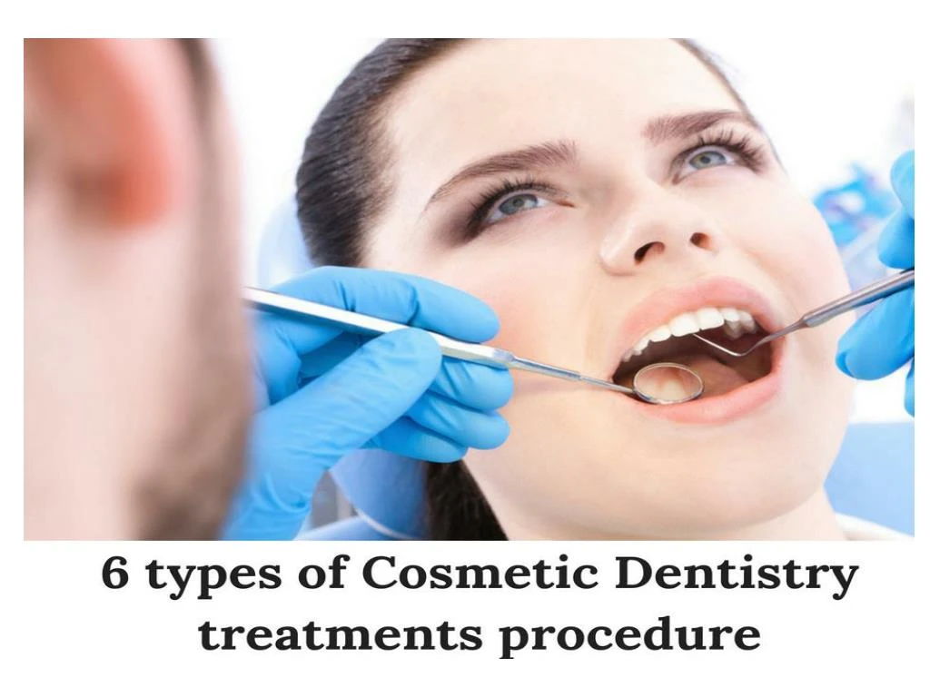 PPT - 6 Types Of Cosmetic Dentistry Procedure For A Confident Smile ...