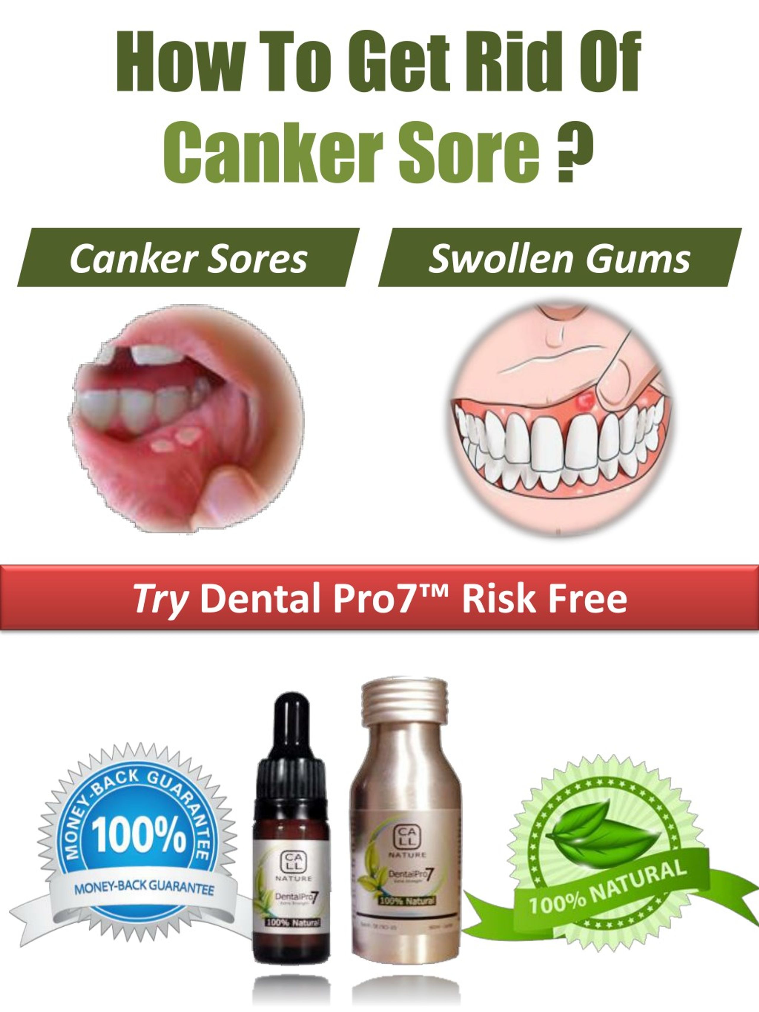 PPT Home Remedy for Canker Sores in the mouth PowerPoint Presentation