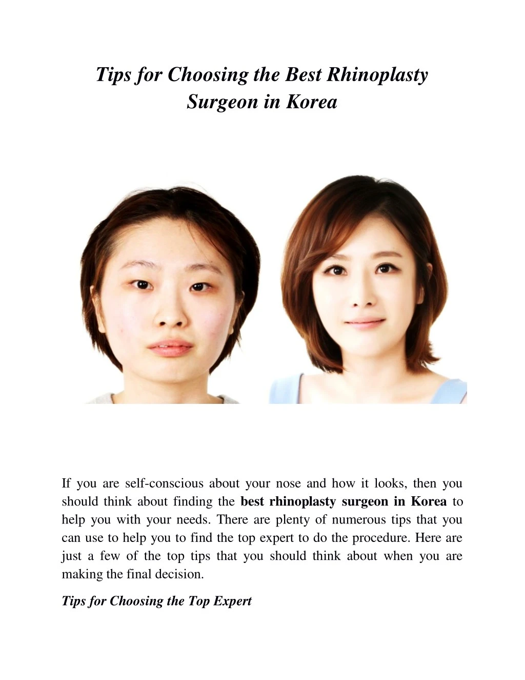tips for choosing the best rhinoplasty surgeon n.