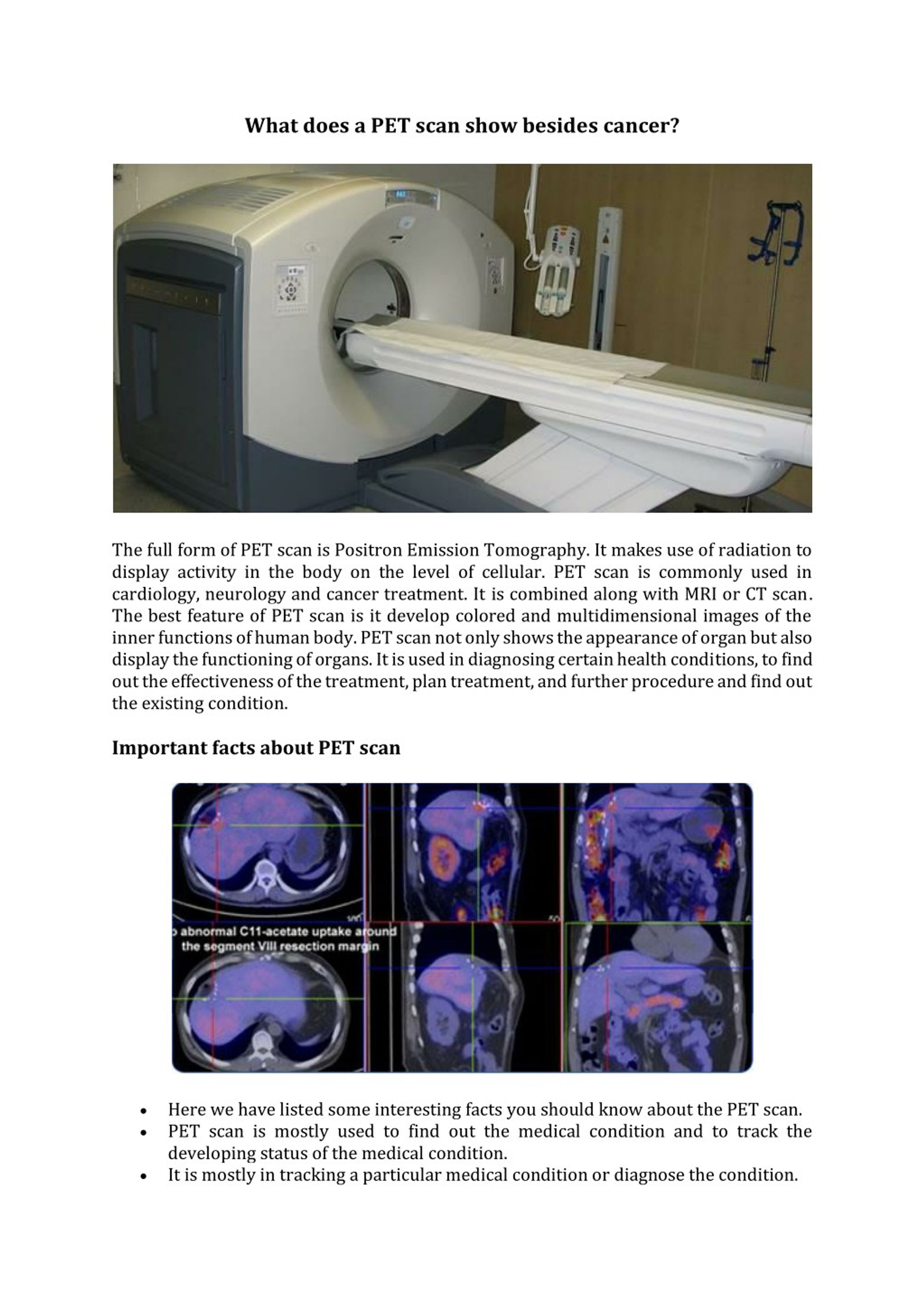 ppt-what-does-a-pet-scan-show-besides-cancer-powerpoint-presentation