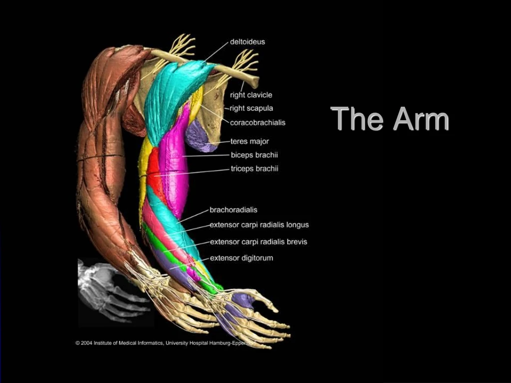 Ppt The Arm Powerpoint Presentation Free Download Id8154009 