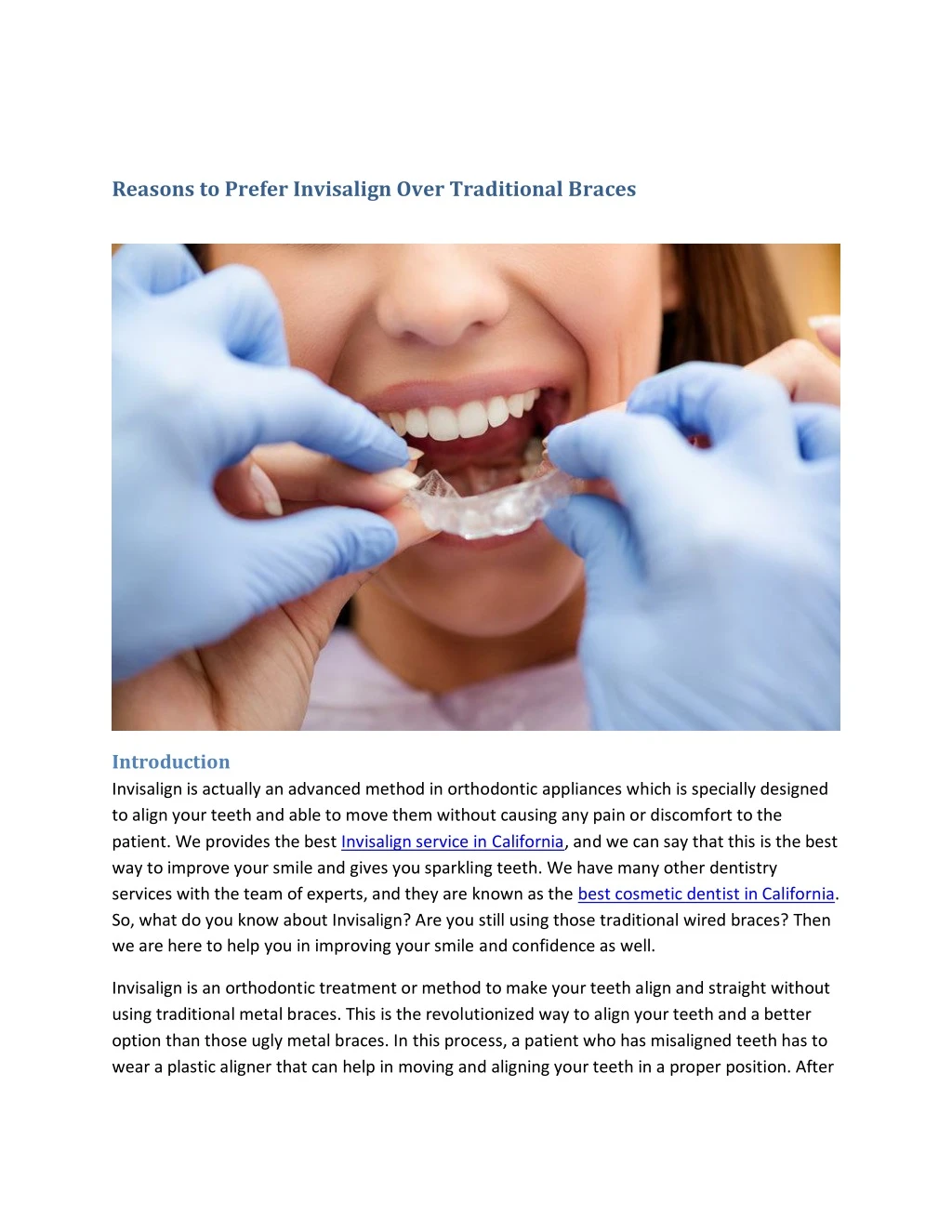 reasons to prefer invisalign over traditional n.