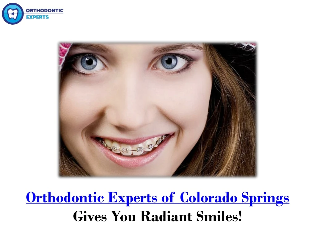 orthodontic experts of colorado springs gives you radiant smiles n.