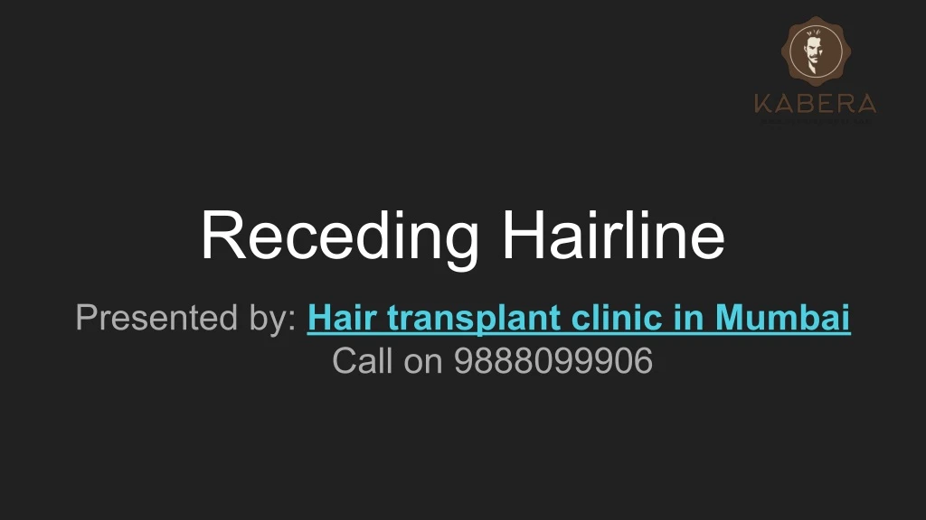 receding hairline n.
