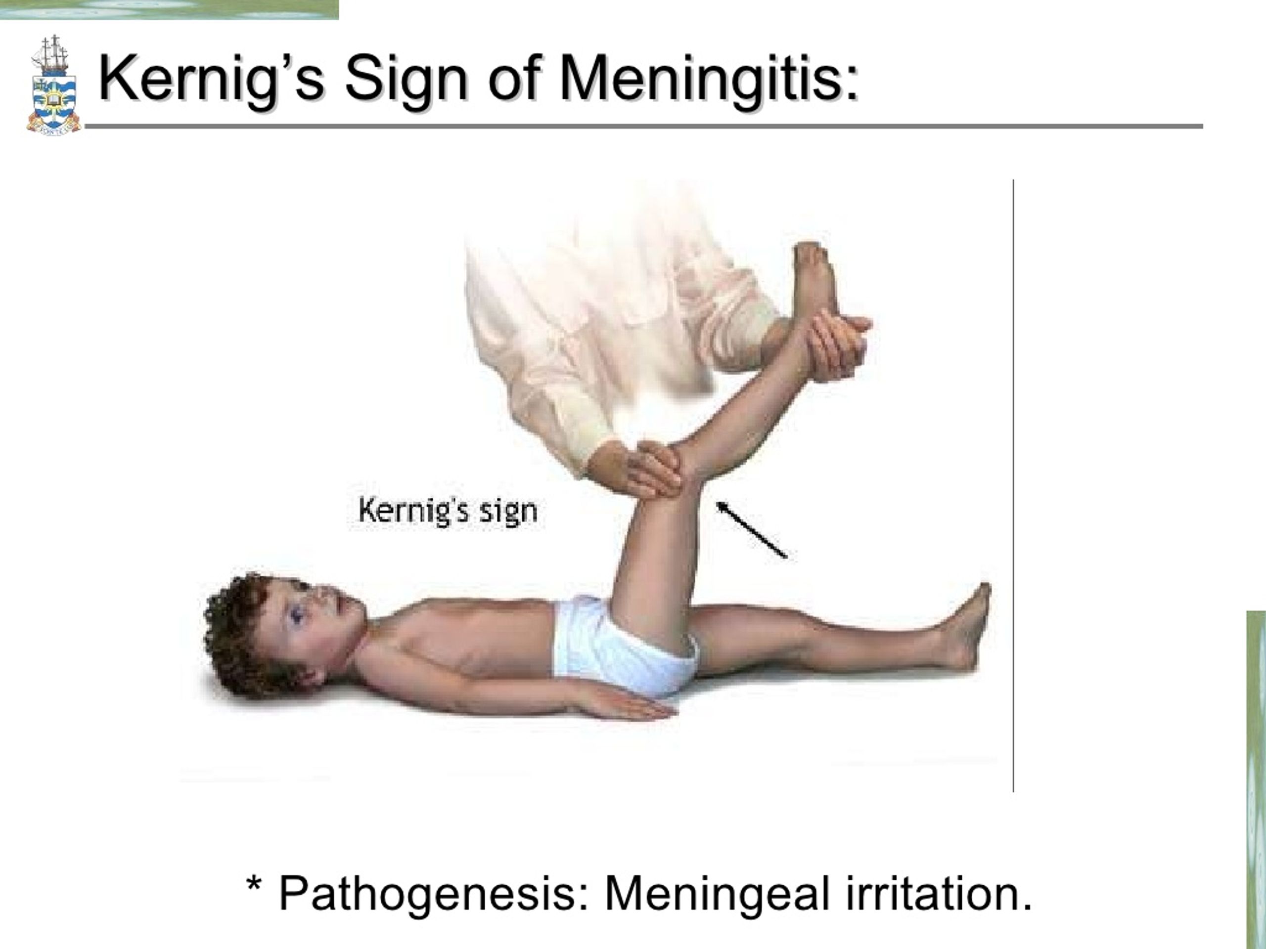 Ppt Pathology Of Meningitis And Cns Infections Powerpoint Presentation