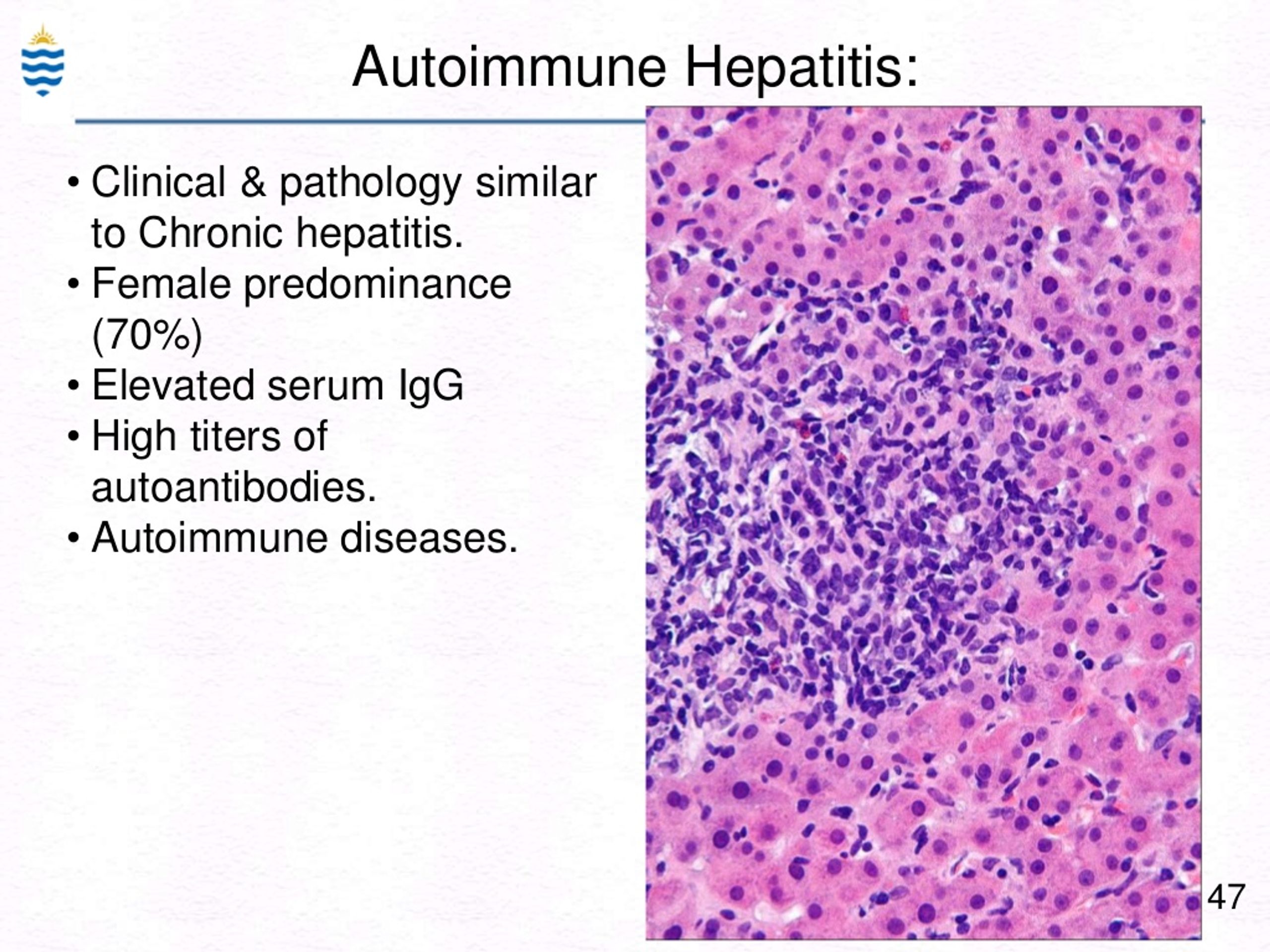 Ppt Pathology Of Hepatitis Lecture Powerpoint Presentation Free Download Id