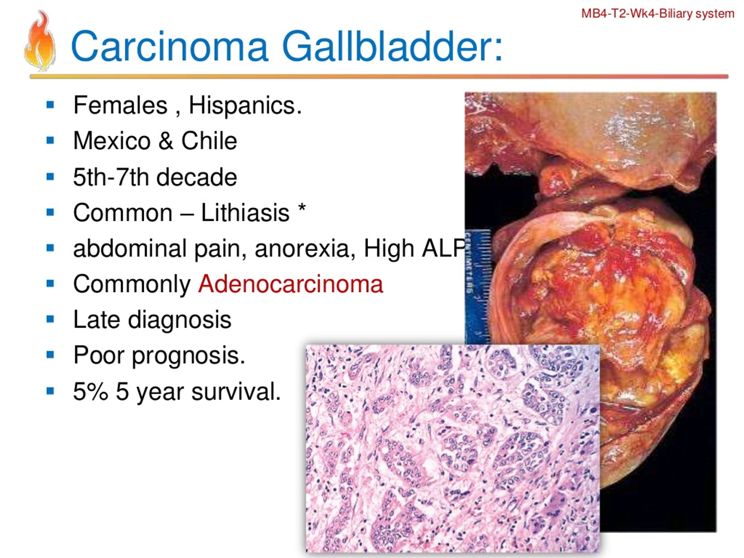 PPT - Pathology Of Biliary Disorders. PowerPoint Presentation, Free ...