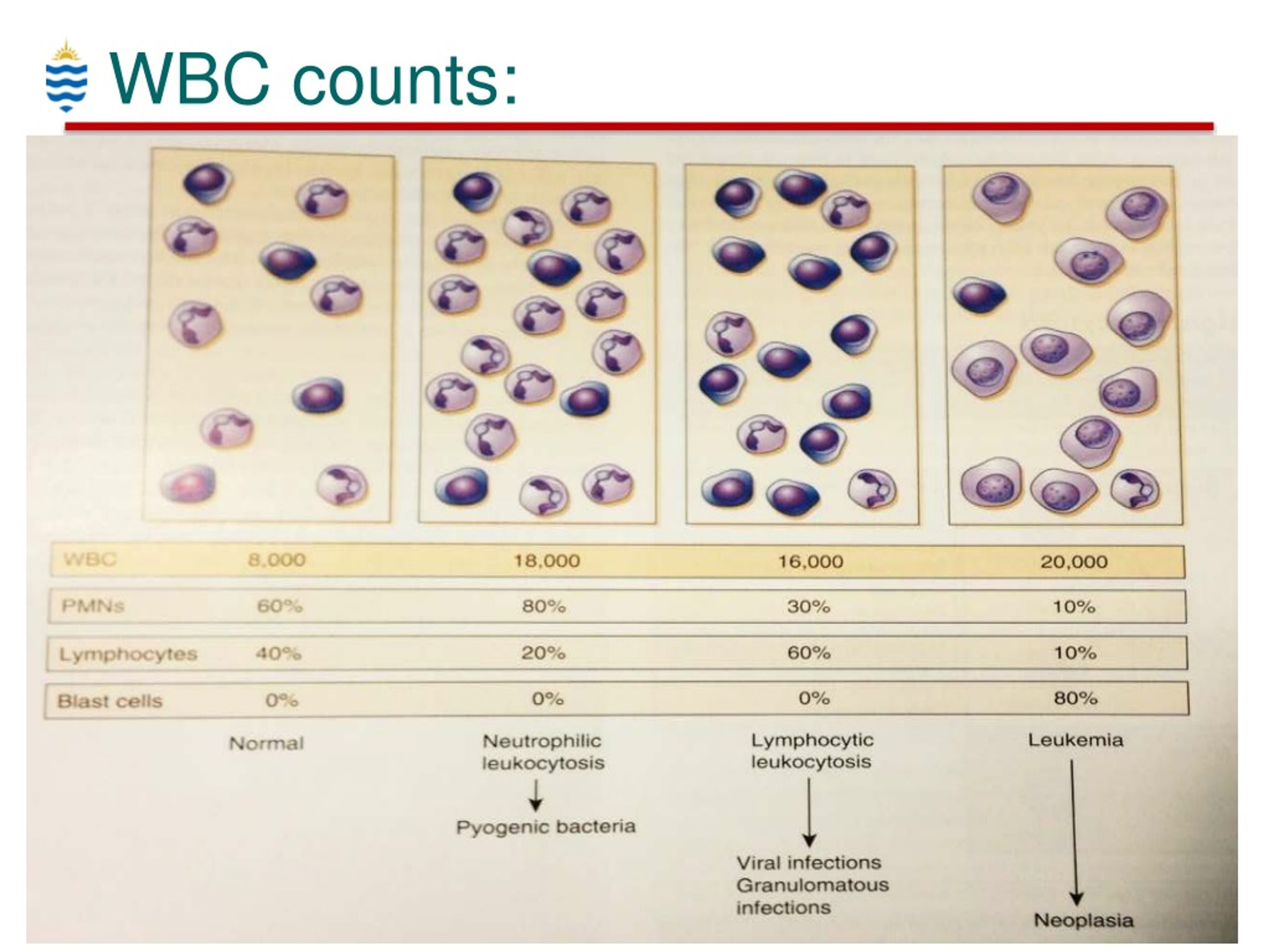 PPT Haematology for Dental Students WBC Disorders PowerPoint