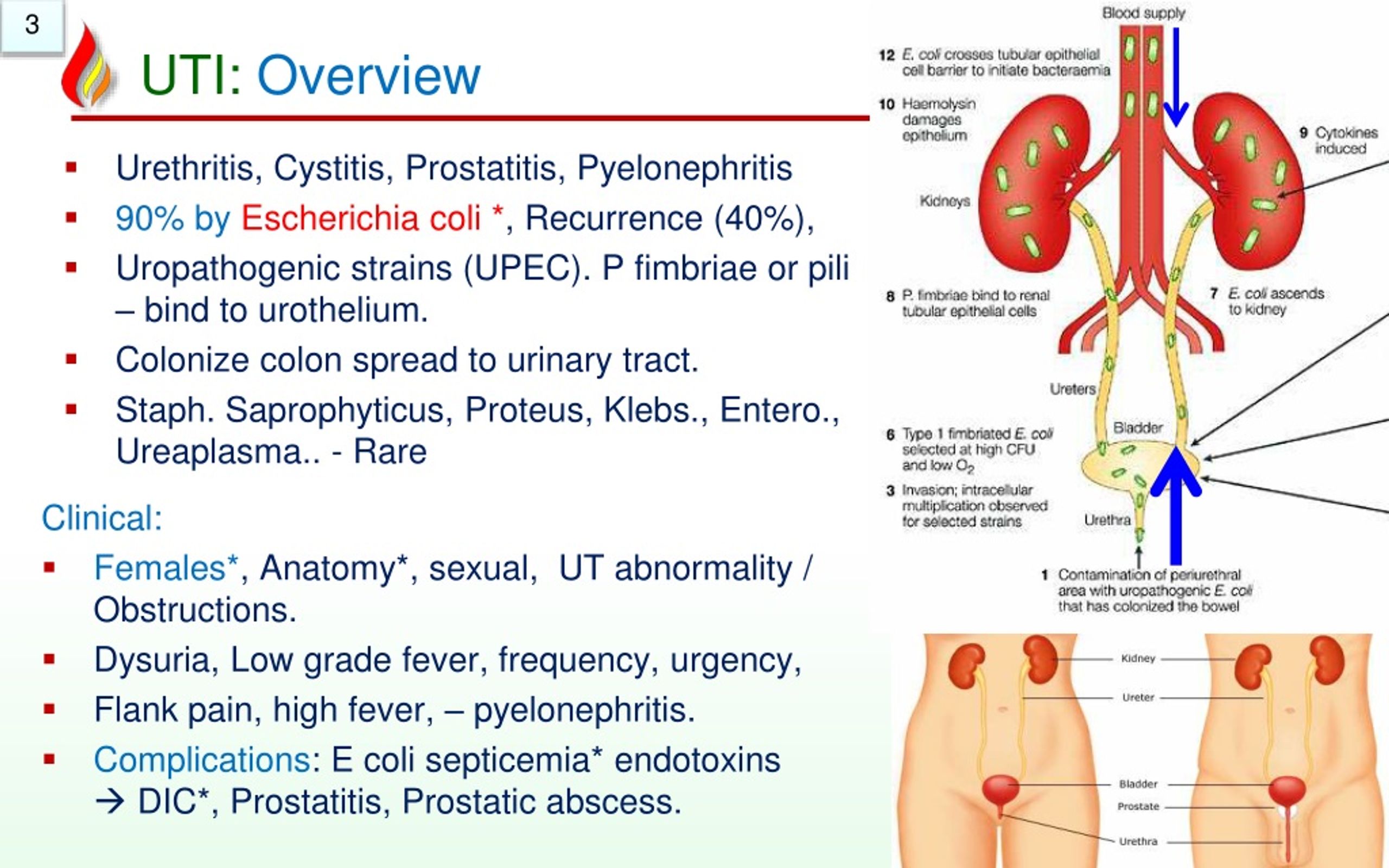 powerpoint presentation on urinary tract infection
