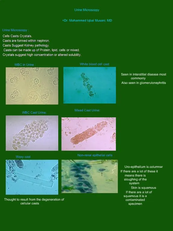 Ppt Urine Microscopy Powerpoint Presentation Free Download Id822567 9318