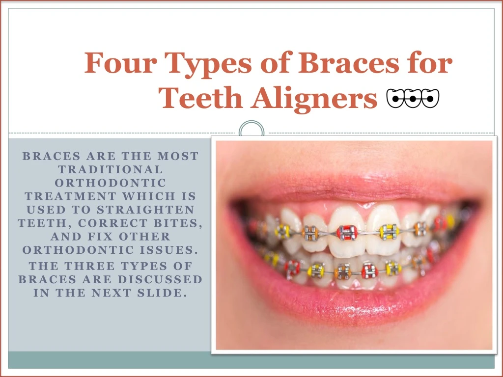 PPT - Four Types of Braces for Teeth Aligners PowerPoint Presentation ...