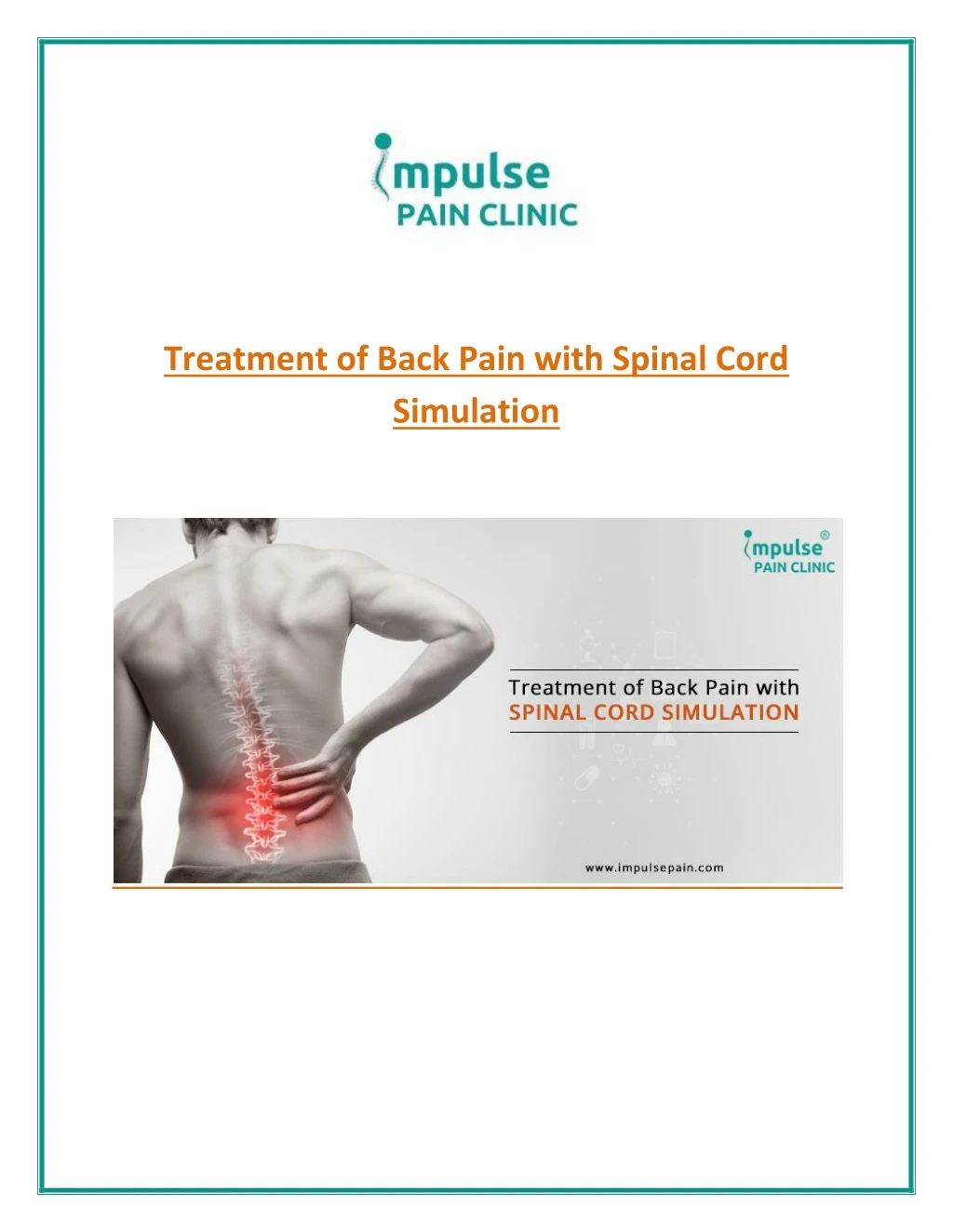 treatment of back pain with spinal cord simulation n.