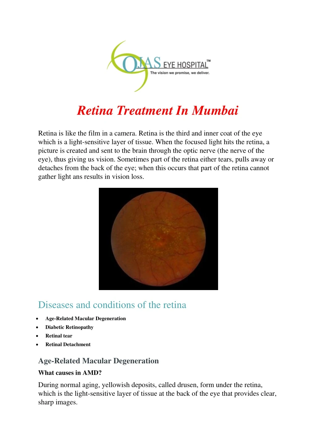 retina treatment in mumbai n.