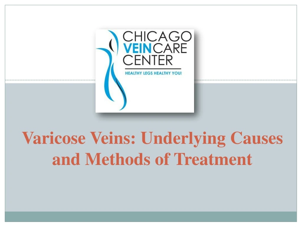 varicose veins underlying causes and methods of treatment n.