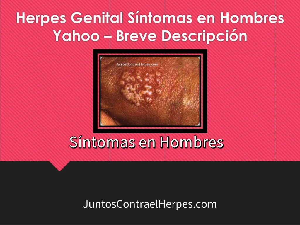 herpes genital s ntomas en hombres yahoo breve descripci n n.