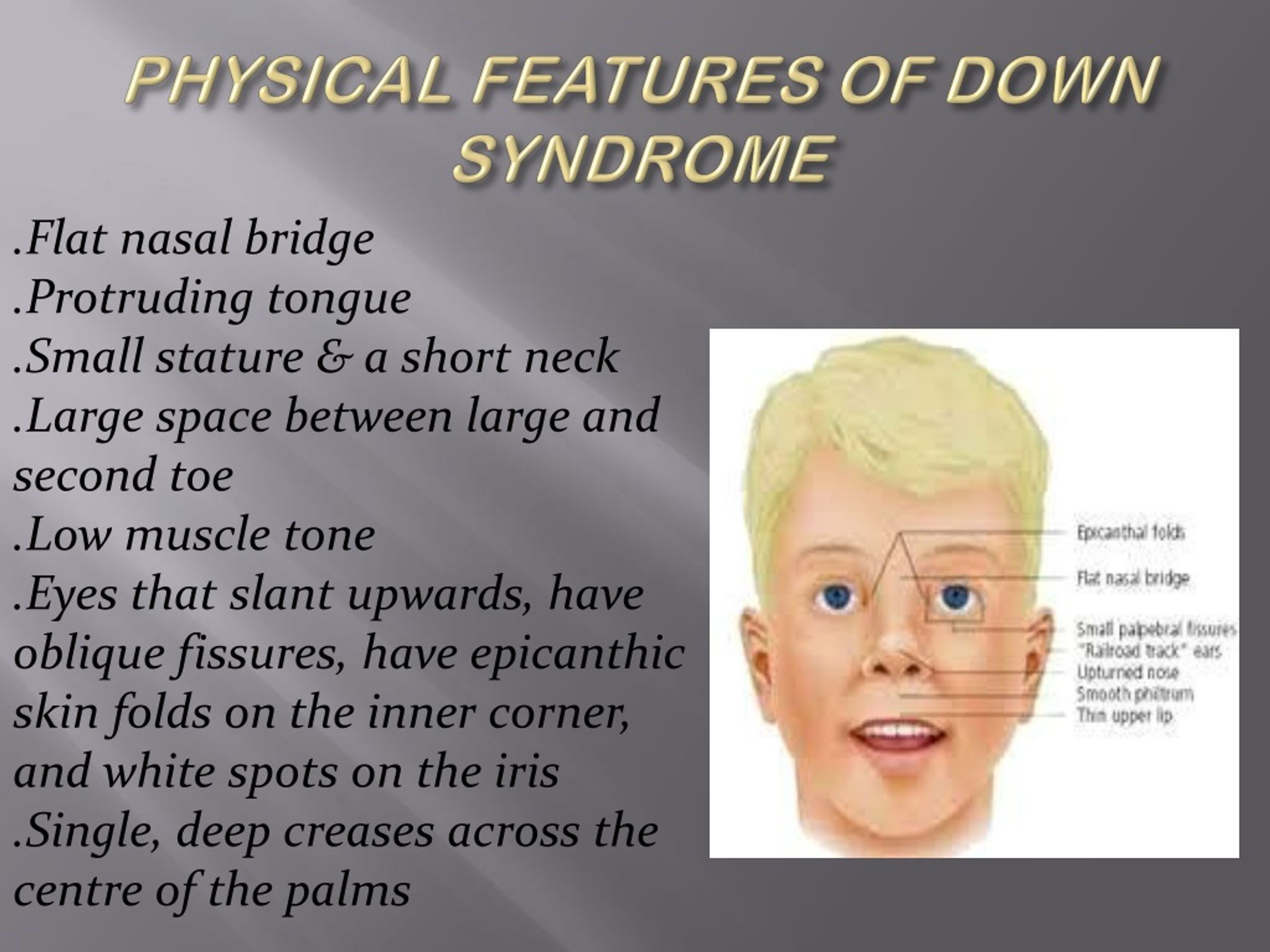 PPT - Down Syndrome Treatment PowerPoint Presentation, free download ...