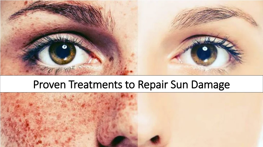 proven treatments to repair sun damage n.