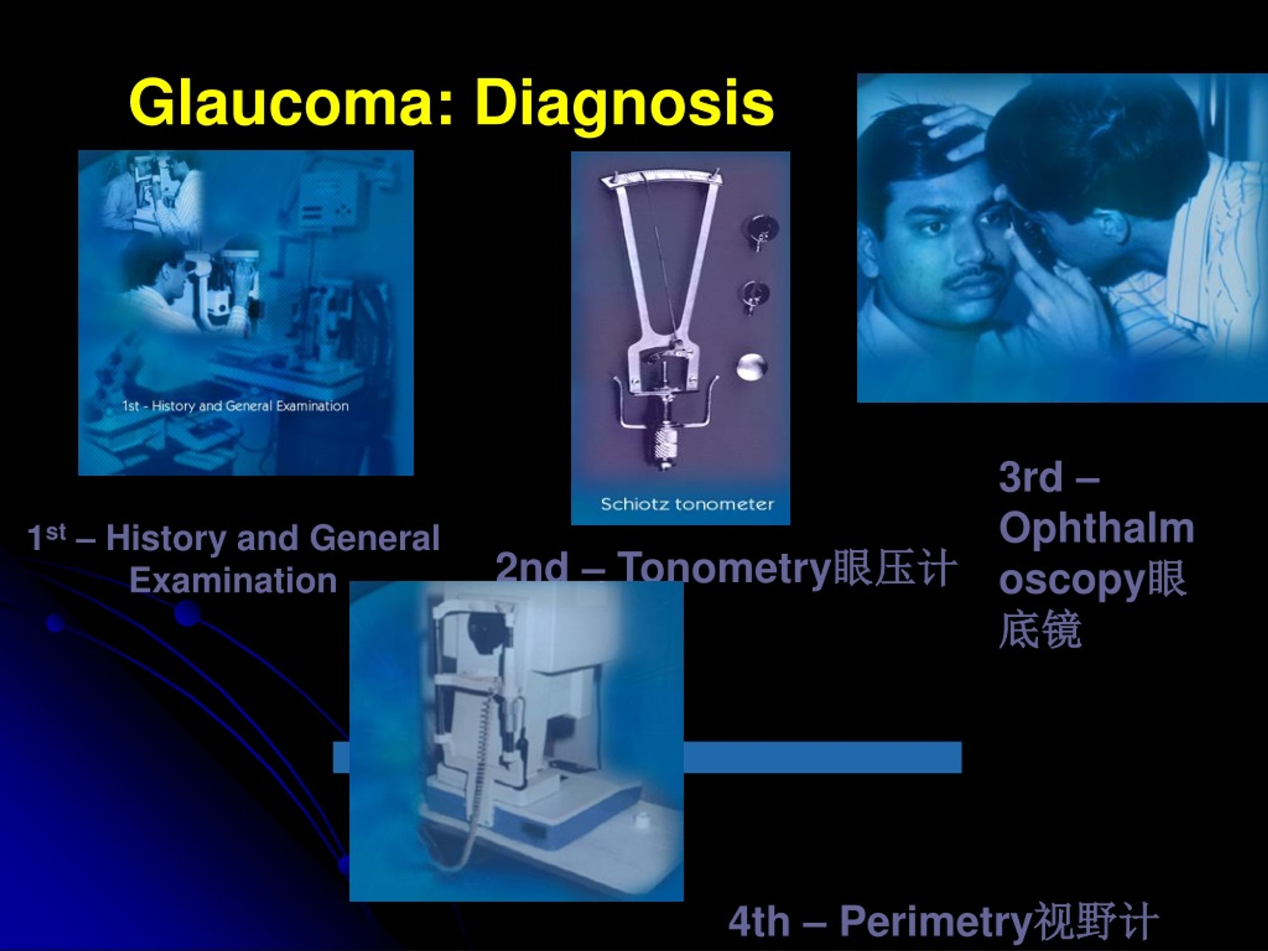 Ppt Glaucoma Powerpoint Presentation Free Download Id8527329 