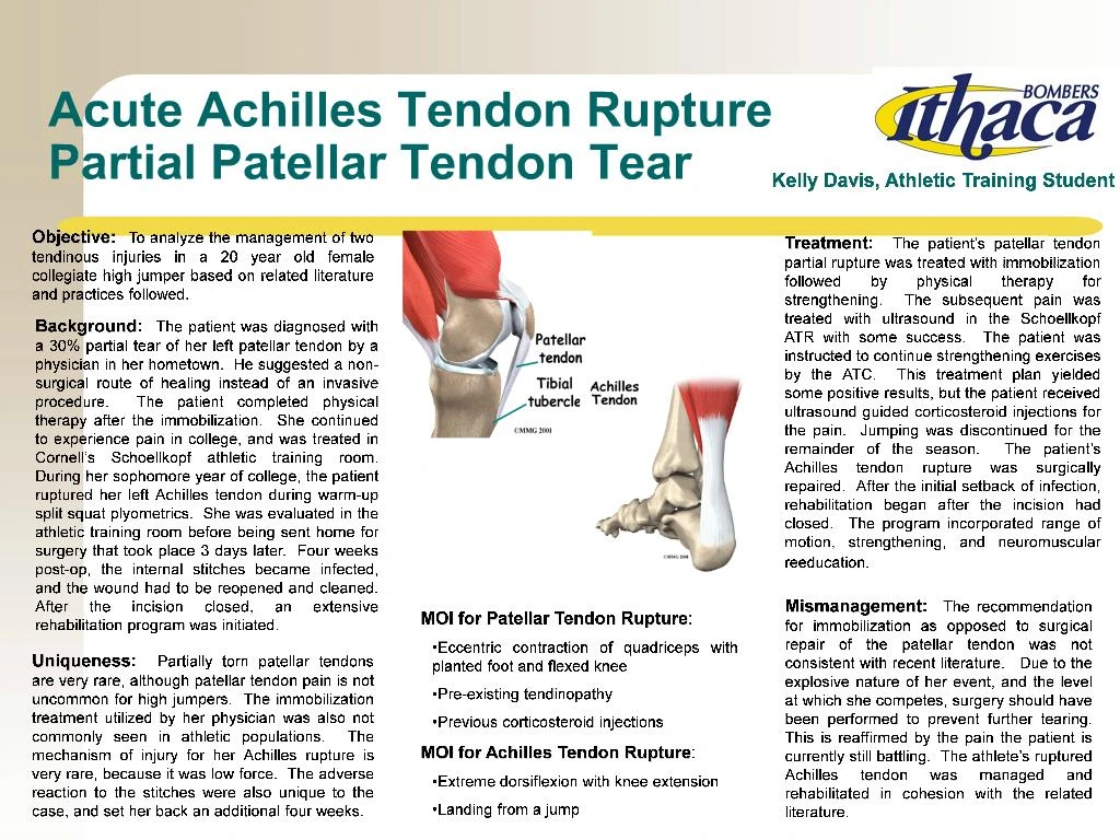 How To Treat A Partial Patellar Tendon Tear