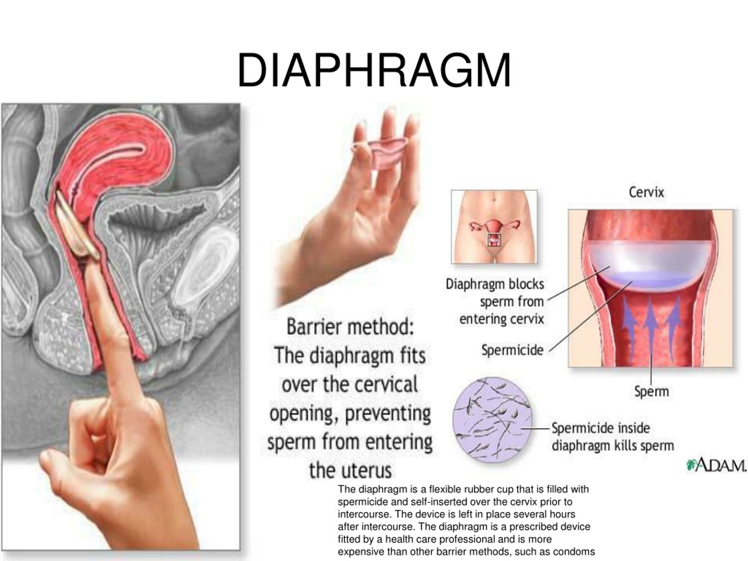 Ppt Hormonal Methods Powerpoint Presentation Free Download Id8670503 1125