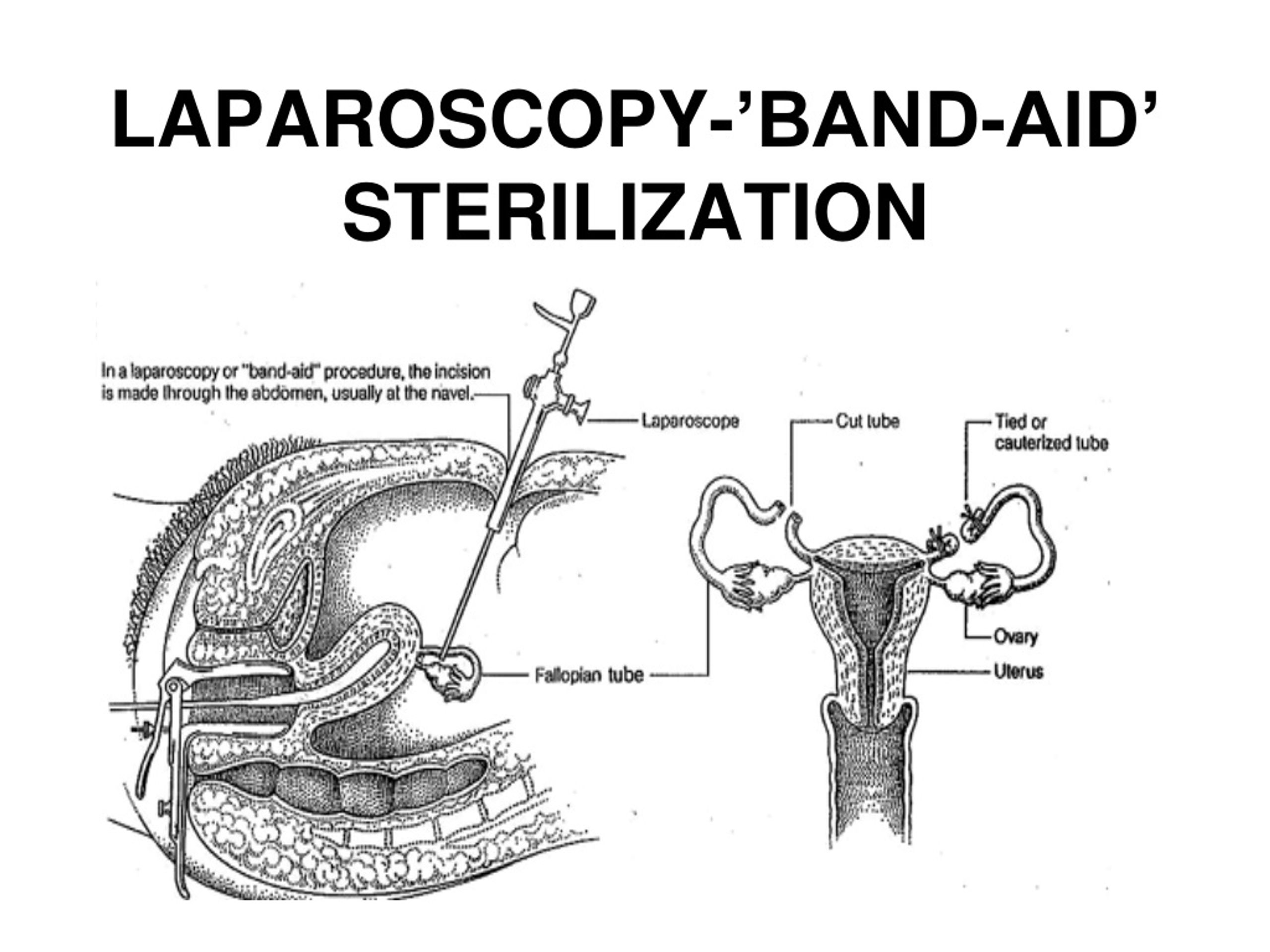 Ppt Hormonal Methods Powerpoint Presentation Free Download Id8670503 3647