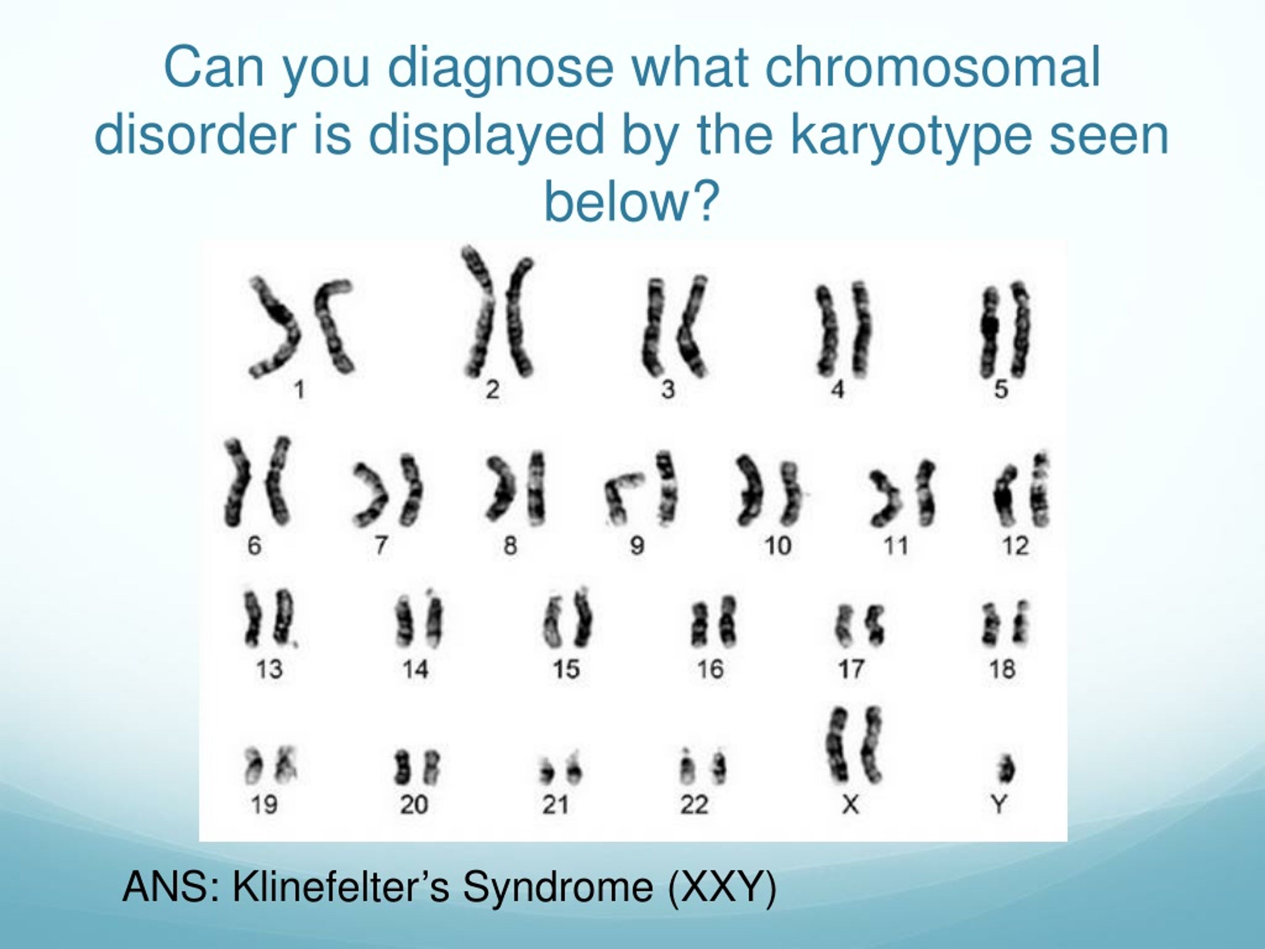 Ppt Chromosomal Disorders And Karyotyping Powerpoint Presentation Free