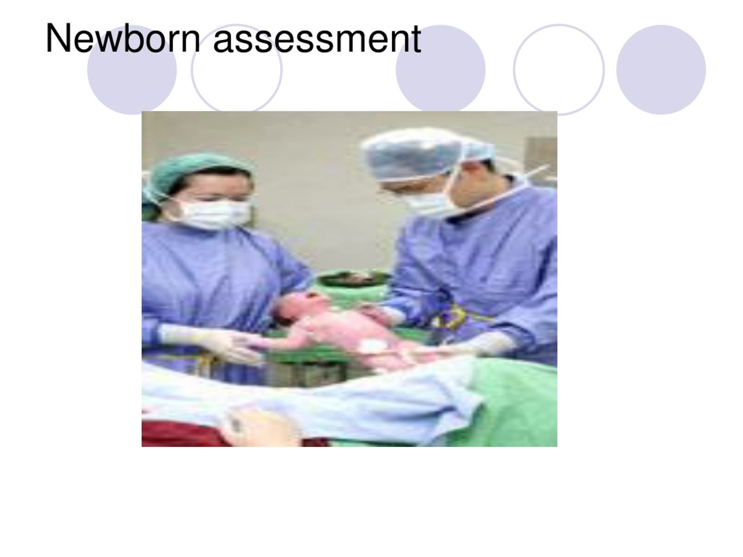 newborn assessment assignment slideshare