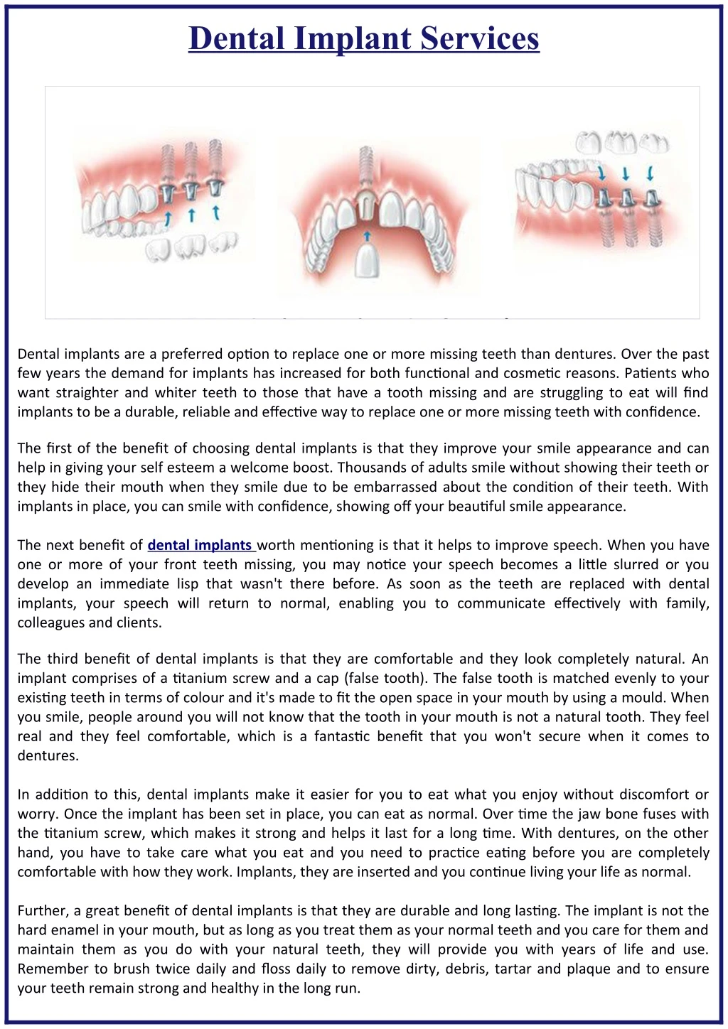 dental implant services n.