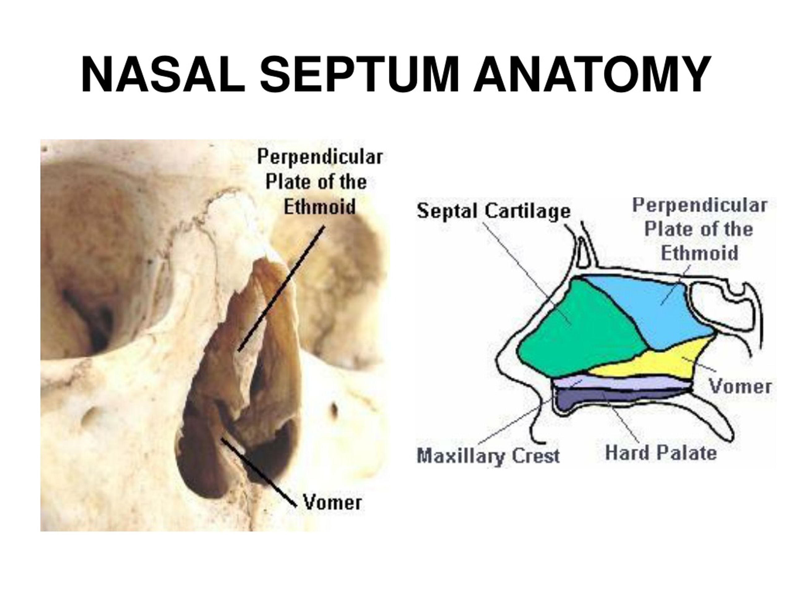 PPT Nasal Septum Anatomy Disorders Treatment Otolaryngology 