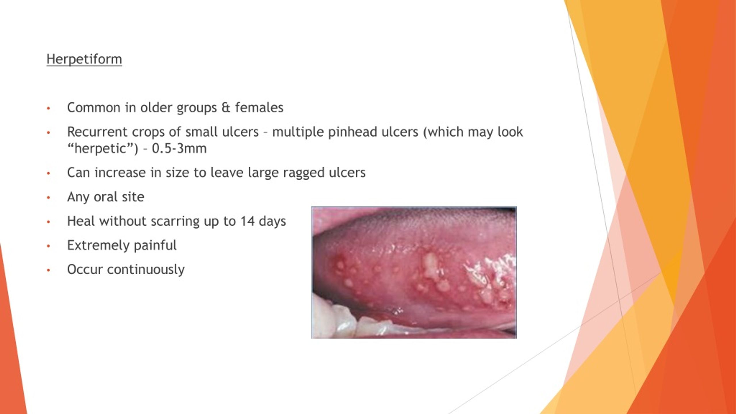 PPT - ORAL ULCERATION PowerPoint Presentation, free download - ID:8768477
