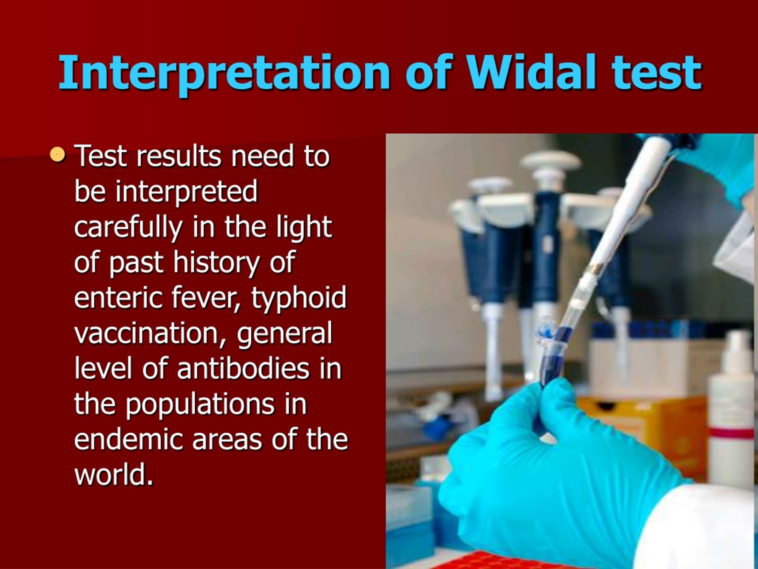 presentation on widal test