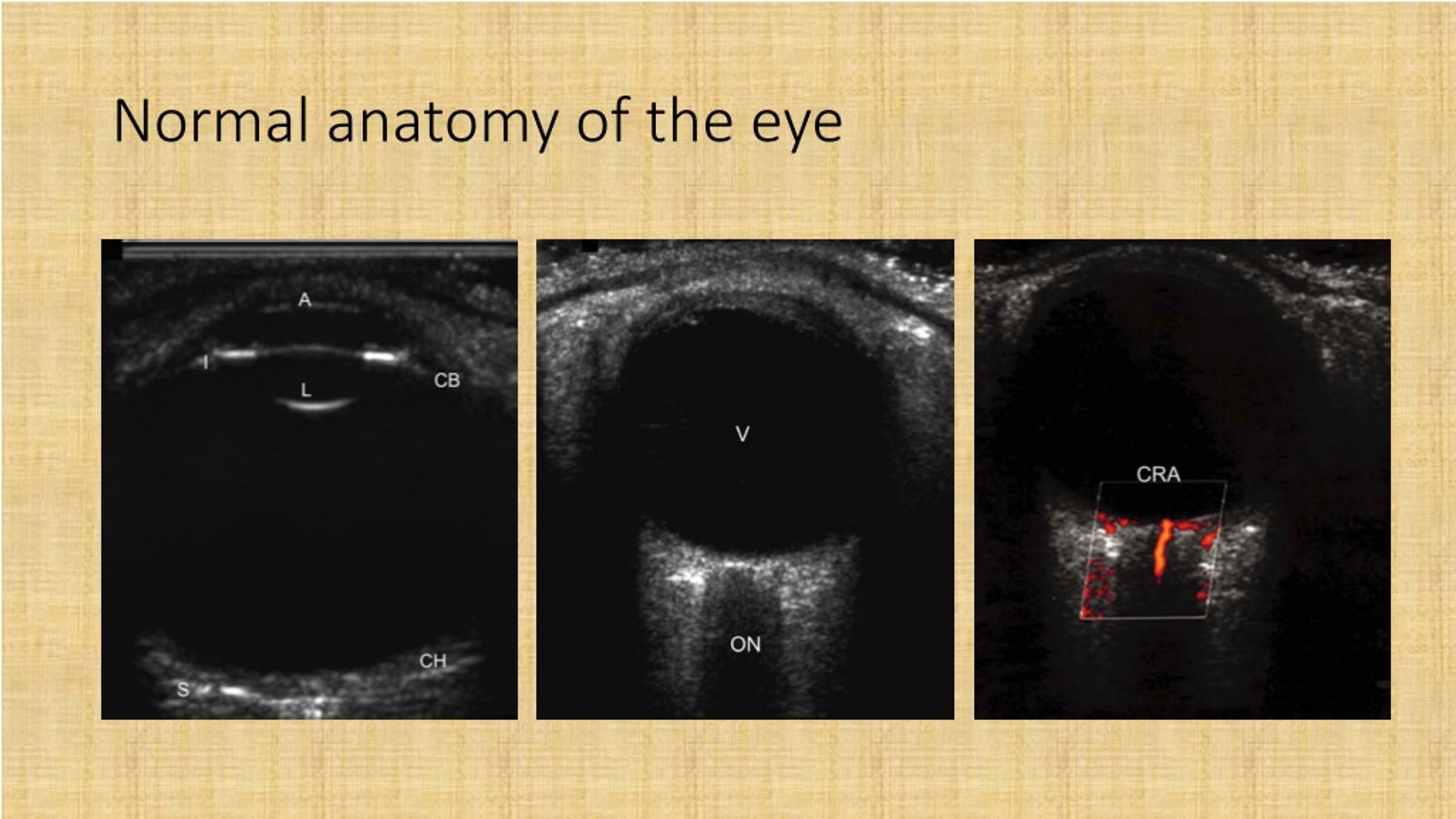 PPT - OCULAR ULTRASOUND PowerPoint Presentation, Free Download - ID:8790093