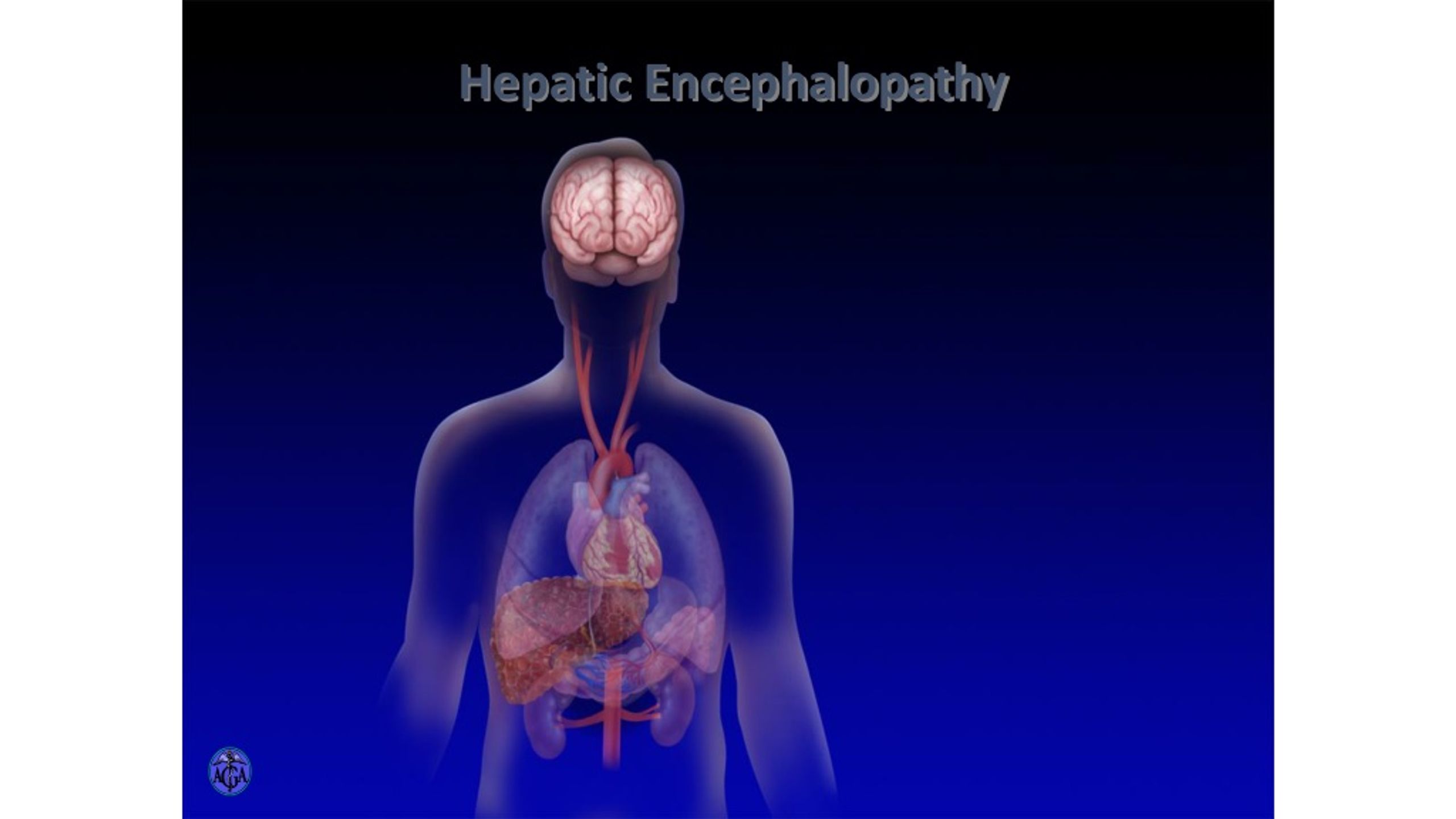 Hepatic Encephalopathy Patient