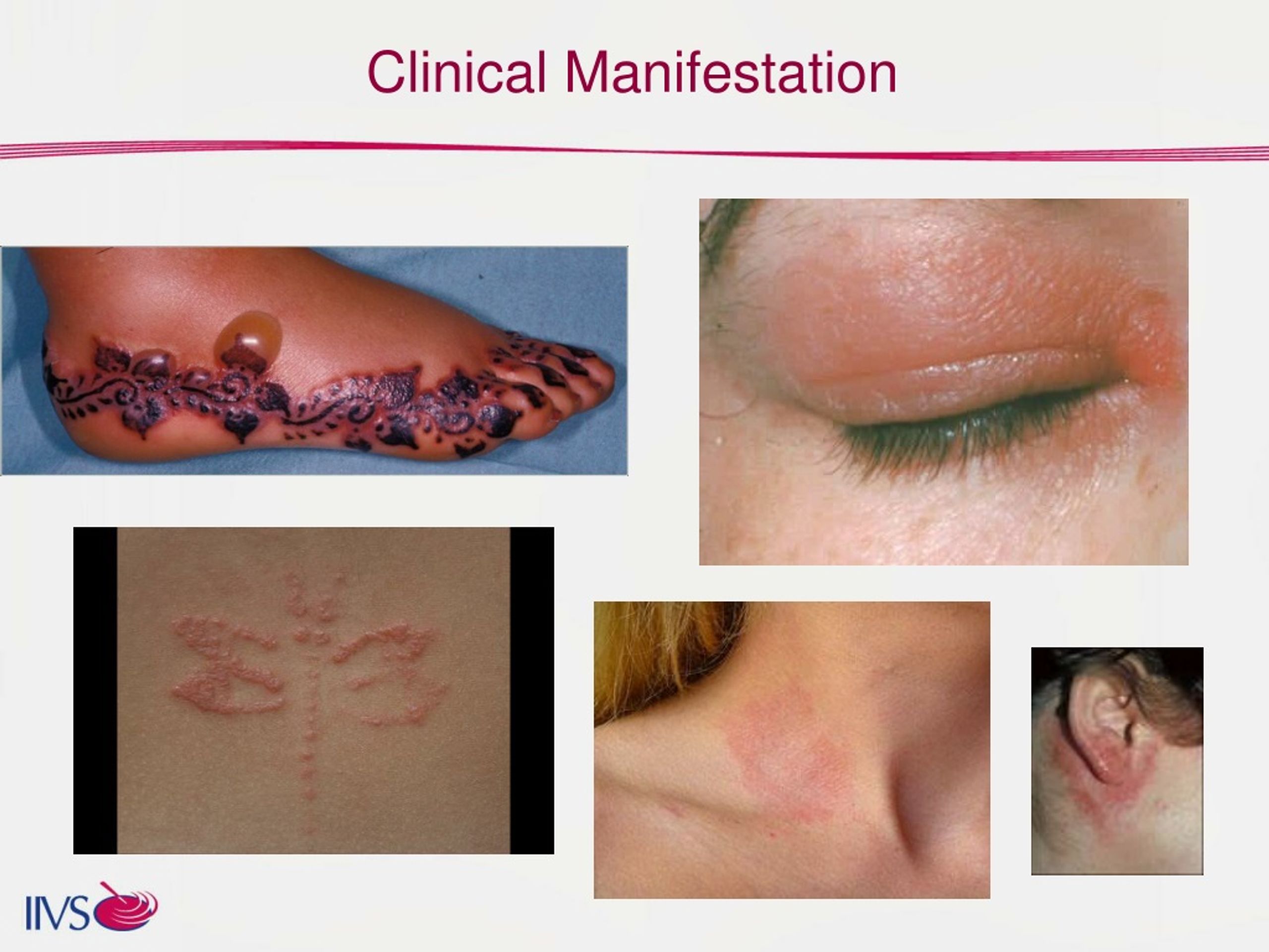 PPT - Skin Sensitization and AOP PowerPoint Presentation, free download ...