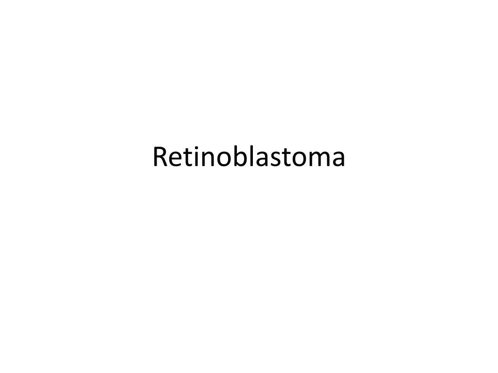 PPT Retinoblastoma PowerPoint Presentation, free download ID8860757